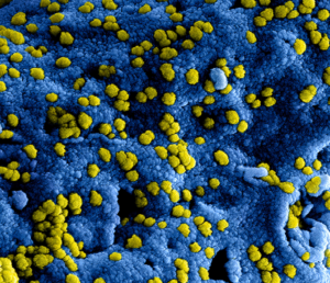 Germs in Memory Care Facility